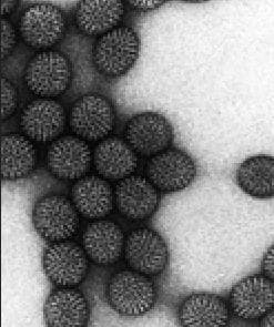 Трансмісійна електронна мікрофотографія ротавірусу.