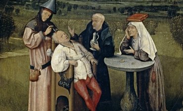 trepanation neurosurgery history