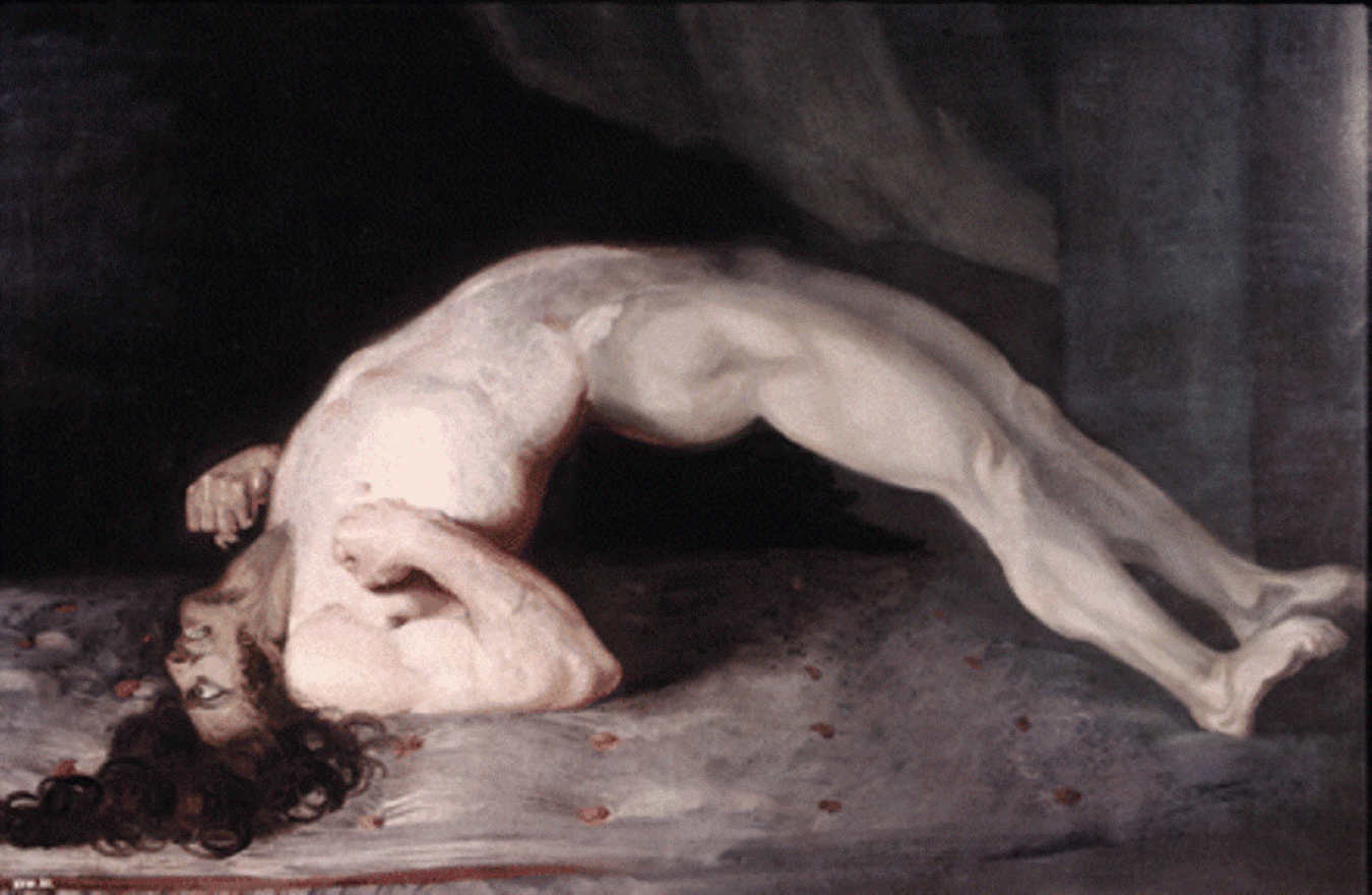 Opisthotonus in a patient suffering from tetanus . Painting by Sir Charles Bell, 1809.