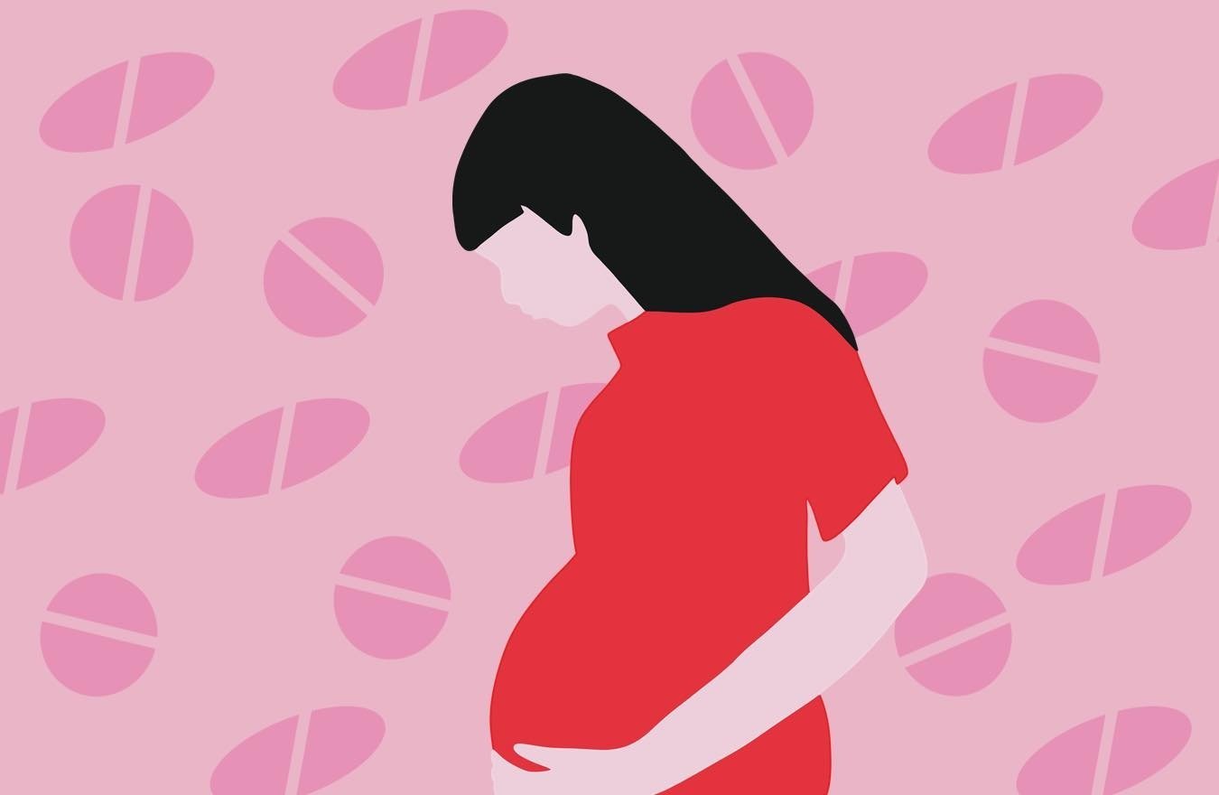 НПЗП вагітність олігогідроамніон