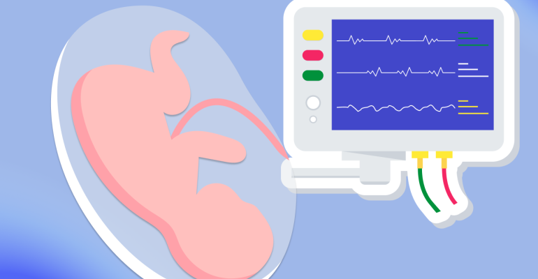 кардіотокографія КТГ фетальний моніторинг акселерації децелерації варібельність вагітність 