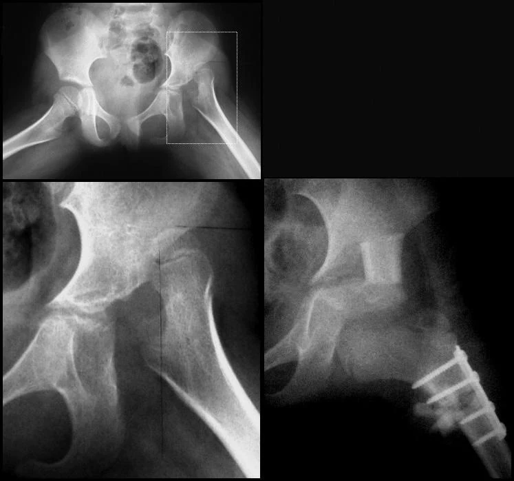 Рентгенограма 6-річної дитини