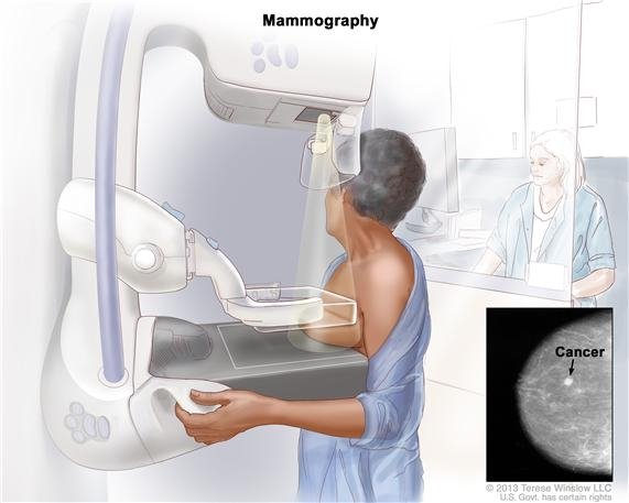 Коли важливо відтермінувати мамографію?
